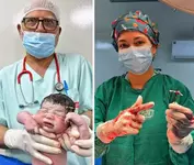 В Бразилии ребёнок родился с внутриматочной спиралью в руке.webp