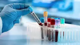 Врачи назвали четыре анализа, которые стоит сдавать каждому к 40 годам.webp