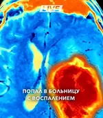 В Ташкенте парень вышел на улицу с мокрой головой и чуть не умер.webp