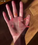 Хайповый тренд привёл девушку к травмам.webp