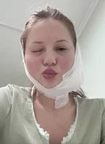 Во Владивостоке девушка хотела удалить зуб мудрости, а получила перекошенное лицо..webp
