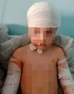 Стая бездомных собак напала на пятилетнюю девочку.webp