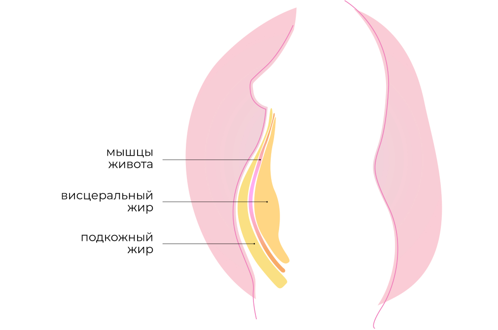 Живот на нервной почве Живот на нервной почве